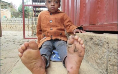 Juillet 2020 : Don d&rsquo;antiseptiques